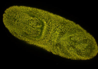 Selective Plane Imaging Microscopy